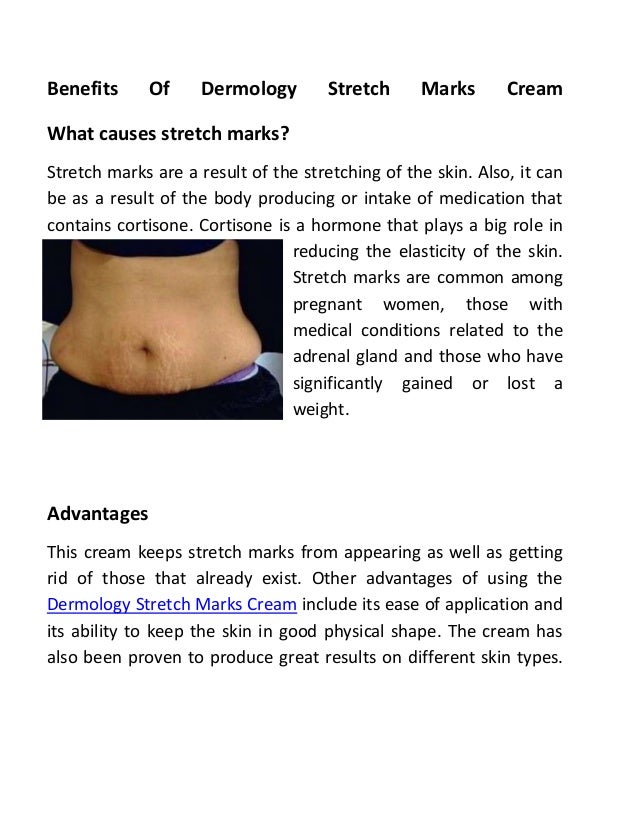 cream to get rid of stretch marks