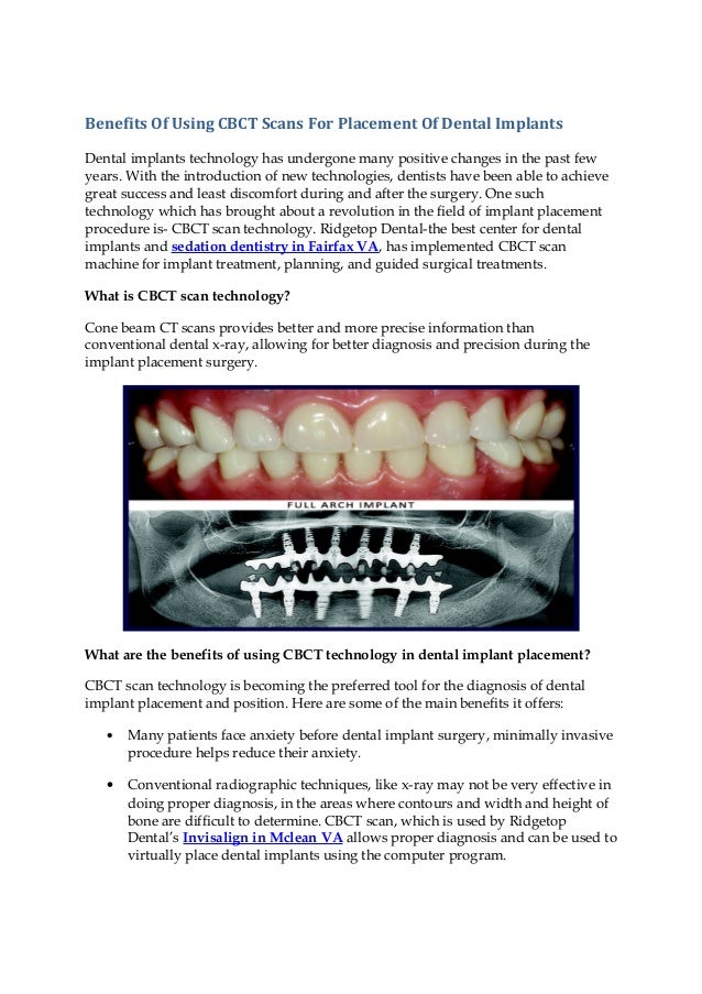 Benefits Of Using CBCT Scans For Placement Of Dental Implants