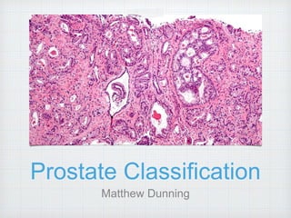 Prostate Classification
Matthew Dunning
 