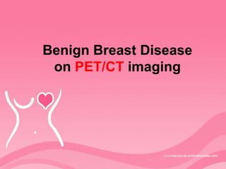 Benign Breast Disease
on PET/CT imaging
 