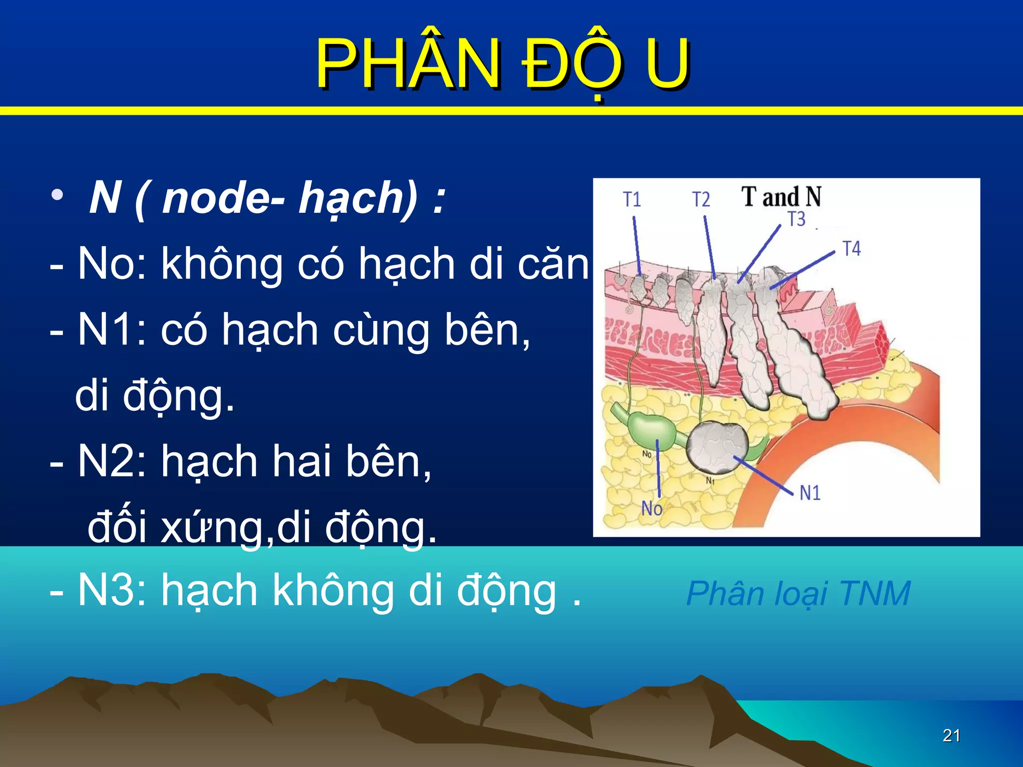 • N ( node- hạch) :
- No: không có hạch di căn.
- N1: có hạch cùng bên,
di động.
- N2: hạch hai bên,
đối xứng,di động.
- N3: hạch không di động . Phân loại TNM
2121
PHÂN ĐỘ UPHÂN ĐỘ U
 