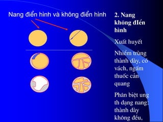 2. Nang
kh«ng ®IÓn
h×nh
XuÊt huyÕt
NhiÓm trïng
thµnh dµy, cã
v¸ch, ngÊm
thuèc c¶n
quang
Ph©n biÖt ung
th d¹ng nang:
thµnh dµy
kh«ng ®Òu,
Nang ®iÓn h×nh vµ kh«ng ®iÓn h×nh
 
