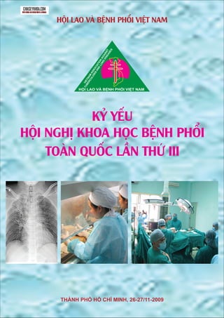 Alt value for image 94