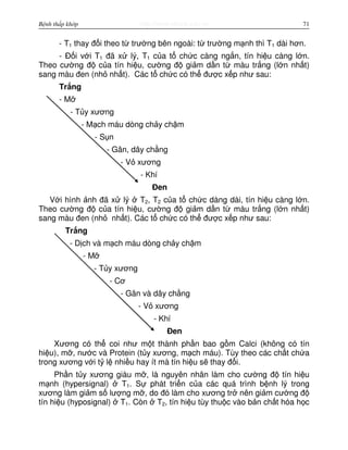 http://www.ebook.edu.vnBệnh thấp khớp 71
- T1 thay đ i theo t trư ng bên ngoài: t trư ng m nh thì T1 dài hơn.
- Đ i v i T1 đã x lý, T1 c a t ch c càng ng n, tín hi u càng l n.
Theo cư ng đ c a tín hi u, cư ng đ gi m d n t màu tr ng (l n nh t)
sang màu đen (nh nh t). Các t ch c có th đư c x p như sau:
Tr ng
- M
- T y xương
- M ch máu dòng ch y ch m
- S n
- Gân, dây ch ng
- V xương
- Khí
Đen
V i hình nh đã x lý T2, T2 c a t ch c dàng dài, tín hi u càng l n.
Theo cư ng đ c a tín hi u, cư ng đ gi m d n t màu tr ng (l n nh t)
sang màu đen (nh nh t). Các t ch c có th đư c x p như sau:
Tr ng
- D ch và m ch máu dòng ch y ch m
- M
- T y xương
- Cơ
- Gân và dây ch ng
- V xương
- Khí
Đen
Xương có th coi như m t thành ph n bao g m Calci (không có tín
hi u), m , nư c và Protein (t y xương, m ch máu). Tùy theo các ch t ch a
trong xương v i t l nhi u hay ít mà tín hi u s thay đ i.
Ph n t y xương giàu m , là nguyên nhân làm cho cư ng đ tín hi u
m nh (hypersignal) T1. S phát tri n c a các quá trình b nh lý trong
xương làm gi m s lư ng m , do đó làm cho xương tr nên gi m cư ng đ
tín hi u (hyposignal) T1. Còn T2, tín hi u tùy thu c vào b n ch t hóa h c
 