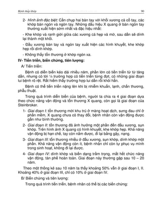 http://www.ebook.edu.vnBệnh thấp khớp 90
2- Hình nh đ c bi t: C n ch p hai bàn tay v i kh i xương cá c tay, các
kh p bàn ngón và ngón tay. Nh ng d u hi u X quang bàn ngón tay
thư ng xu t hi n s m nh t và đ c hi u nh t:
- Khe kh p và ranh gi i gi a các xương cá h p và m , sau d n s dính
l i thành m t kh i.
- Đ u xương bàn tay và ngón tay xu t hi n các hình khuy t, khe kh p
h p r i dính kh p.
- Không th y t n thương kh p ngón xa.
IV- Ti n tri n, bi n ch ng, tiên lư ng:
A/ Ti n tri n:
B nh có di n bi n kéo dài nhi u năm, ph n l n có ti n tri n t t tăng
d n, nhưng có t i ¼ trư ng h p có ti n tri n t ng đ t, có nh ng giai đo n
lui b nh rõ r t. R t hi m th y trư ng h p lui d n r i kh i h n.
B nh có th ti n tri n n ng lên khi b nhi m khu n, l nh, ch n thương,
ph u thu t.
Trong quá trình di n bi n c a b nh, ngư i ta chia ra 4 giai đo n d a
theo ch c năng v n đ ng và t n thương X quang, còn g i là giai đo n c a
Steinbroker.
1- Giai đo n I: t n thương m i khu trú màng ho t d ch, sưng đau ch
ph n m m, X quang chưa có thay đ i, b nh nhân còn v n đ ng đư c
g n như bình thư ng.
2- Giai đo n II: t n thương đã nh hư ng m t ph n đ n đ u xương, s n
kh p. Trên hình nh X quang có hình khuy t, khe kh p h p. Kh năng
v n đ ng b h n ch , tay còn n m đư c, đi l i b ng g y, n ng.
3- Giai đo n III: t n thương nhi u đ u xương, s n kh p, dính kh p m t
ph n. Kh năng v n đ ng còn ít, b nh nhân ch còn t ph c v mình
trong sinh ho t, không đi l i đư c.
4- Giai đo n IV: dính kh p và bi n d ng tr m tr ng, m t h t ch c năng
v n đ ng, tàn ph hoàn toàn. Giai đo n này thư ng g p sau 10 – 20
năm.
Theo m t th ng kê sau 10 năm ta th y kho ng 50% v n giai đo n I, II.
Kho ng 40% giai đo n III, ch có 10% giai đo n IV.
B/ Bi n ch ng và tiên lư ng:
Trong quá trình ti n tri n, b nh nhân có th b các bi n ch ng:
 