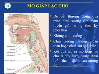 MÔ GIÁP LẠC CHỔ
 Do bất thường trong quá
trình chui xuống của mầm
tuyến giáp trong thời kỳ
phôi thai
 Không chui xuống
 Chui xuống không hoàn
toàn hoặc chui sâu quá mức
 Kết quả tạo ra mô giáp lạc
chổ ở đáy lưỡi, vùng dưới
lưỡi, thanh quản, sau xương
ức
13
 