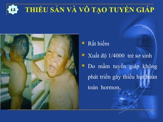 THIỂU SẢN VÀ VÔ TẠO TUYẾN GIÁP
 Rất hiếm
 Xuất độ 1/4000 trẻ sơ sinh
 Do mầm tuyến giáp không
phát triển gây thiếu hụt hoàn
toàn hormon,
15
 