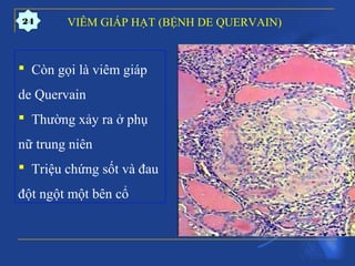 VIÊM GIÁP HẠT (BỆNH DE QUERVAIN)
 Còn gọi là viêm giáp
de Quervain
 Thường xảy ra ở phụ
nữ trung niên
 Triệu chứng sốt và đau
đột ngột một bên cổ
24
 