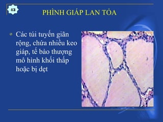 PHÌNH GIÁP LAN TỎA
o Các túi tuyến giãn
rộng, chứa nhiều keo
giáp, tế bào thượng
mô hình khối thấp
hoặc bị dẹt
43
 