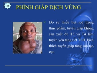  Do sự thiếu hụt iod trong
thực phẩm, tuyến giáp không
sản xuất đủ T3 và T4 làm
tuyến yên tăng tiết TSH, kích
thích tuyến giáp tăng sản tạo
cục.
PHÌNH GIÁP DỊCH VÙNG49
 