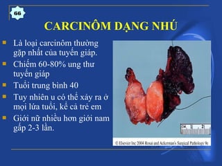 CARCINÔM DẠNG NHÚ
 Là loại carcinôm thường
gặp nhất của tuyến giáp.
 Chiếm 60-80% ung thư
tuyến giáp
 Tuổi trung bình 40
 Tuy nhiên u có thể xảy ra ở
mọi lứa tuổi, kể cả trẻ em
 Giới nữ nhiều hơn giới nam
gấp 2-3 lần.
66
 