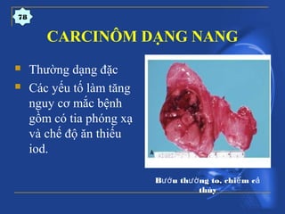 CARCINÔM DẠNG NANG
78
 Thường dạng đặc
 Các yếu tố làm tăng
nguy cơ mắc bệnh
gồm có tia phóng xạ
và chế độ ăn thiếu
iod.
B u th ng to, chi m cướ ườ ế ả
thùy
 