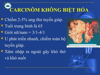 CARCINÔM KHÔNG BIỆT HÓA
 Chiếm 2-5% ung thư tuyến giáp.
 Tuổi trung bình là 65
 Giới nữ/nam = 3/1-4/1
 U phát triển nhanh, chiếm toàn bộ
tuyến giáp.
 Xâm nhập ra ngoài gây khó thở
và khó nuốt
86
 