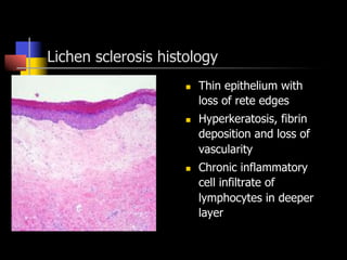 Lichen sclerosis histology
n  Thin epithelium with
loss of rete edges
n  Hyperkeratosis, fibrin
deposition and loss of
vascularity
n  Chronic inflammatory
cell infiltrate of
lymphocytes in deeper
layer
 