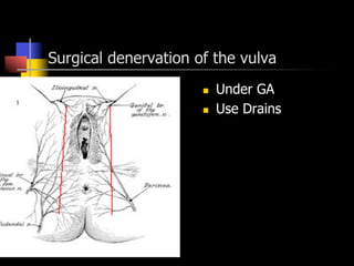 Surgical denervation of the vulva
n  Under GA
n  Use Drains
 