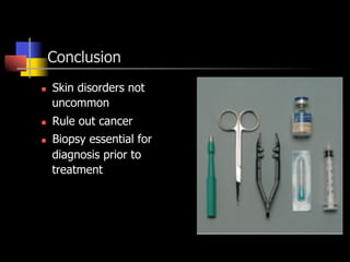 Conclusion
n  Skin disorders not
uncommon
n  Rule out cancer
n  Biopsy essential for
diagnosis prior to
treatment
 