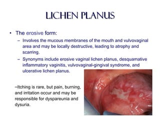 Lichen planusLichen planus
• The erosive form:
– Involves the mucous membranes of the mouth and vulvovaginal
area and may be locally destructive, leading to atrophy and
scarring.
– Synonyms include erosive vaginal lichen planus, desquamative
inflammatory vaginitis, vulvovaginal-gingival syndrome, and
ulcerative lichen planus.
–Itching is rare, but pain, burning,
and irritation occur and may be
responsible for dyspareunia and
dysuria.
 