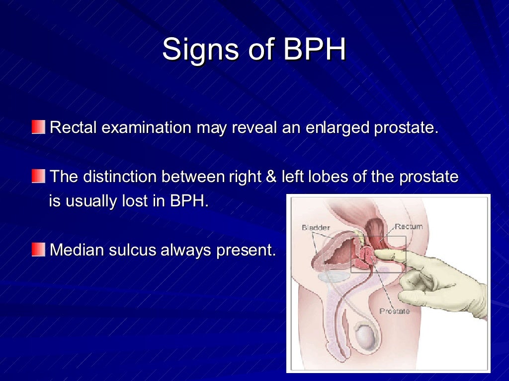 Benign malignant diseases of the prostate