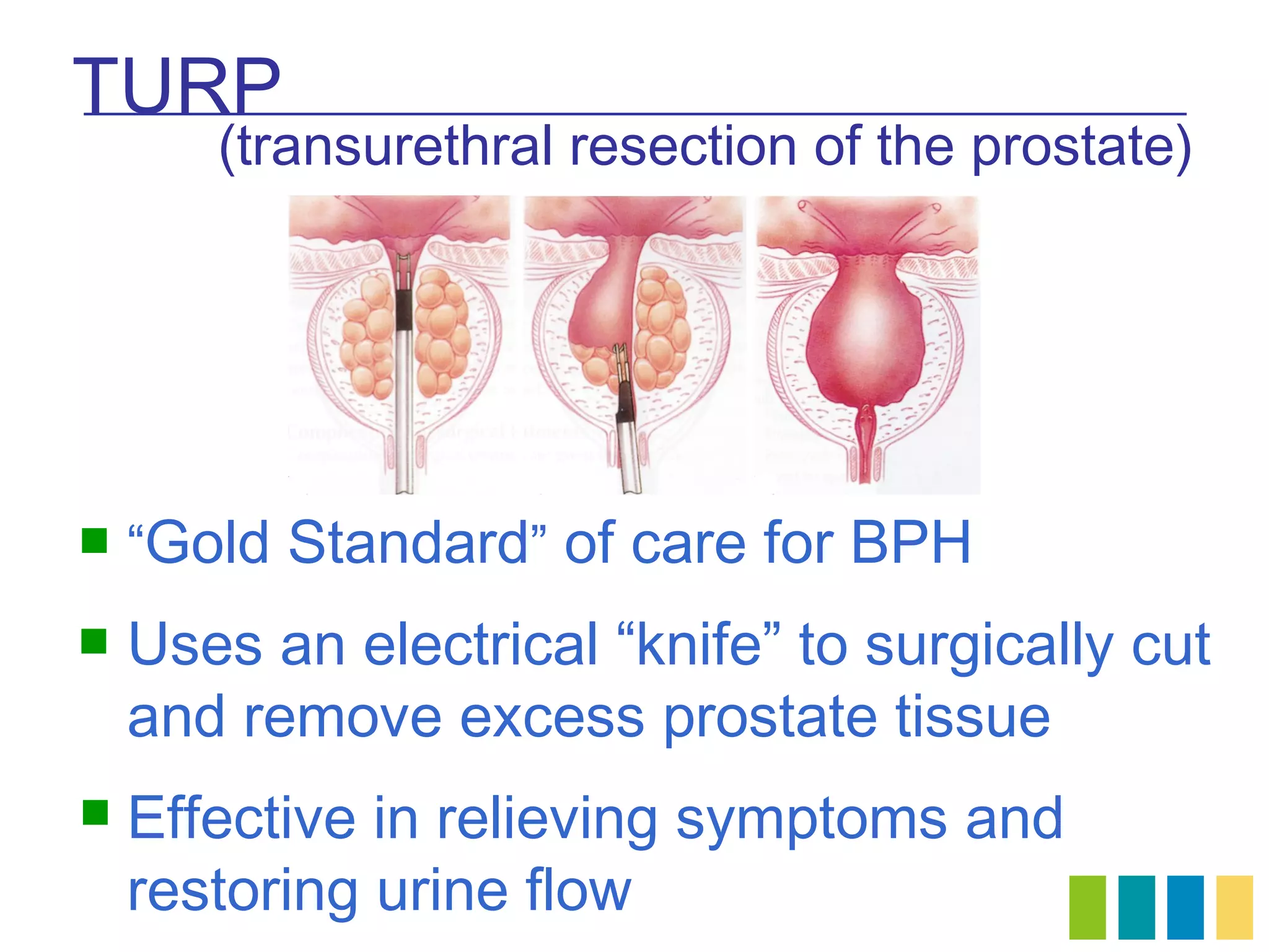 TURP
       (transurethral resection of the prostate)




   “Gold Standard” of care for BPH
   Uses an electrical “knife” to surgically cut
    and remove excess prostate tissue
   Effective in relieving symptoms and
    restoring urine flow
 