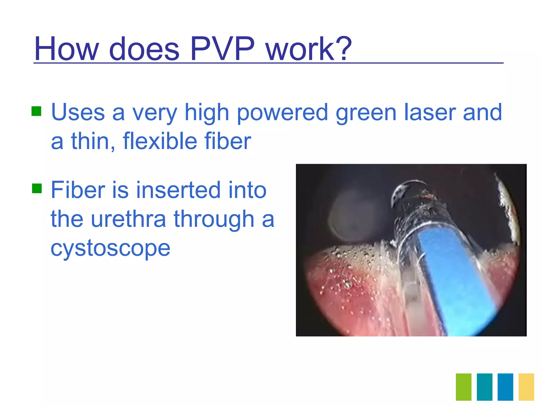 How does PVP work?
   Uses a very high powered green laser and
    a thin, flexible fiber
   Fiber is inserted into
    the urethra through a
    cystoscope
 