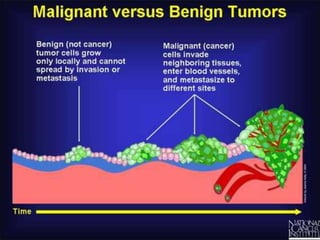 Benign and malignant tumor comparison | PPTX