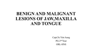 BENIGN AND MALIGNANT
LESIONS OF JAW,MAXILLA
AND TONGUE
Capt;Ye Yint Aung
PG-2nd Year
ORL-HNS
 
