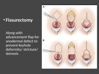 Comprehensive Overview of Anal Canal Anatomy and Benign Anorectal ...