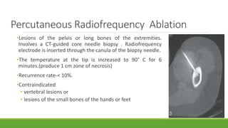 Benign bone forming tumors | PPTX