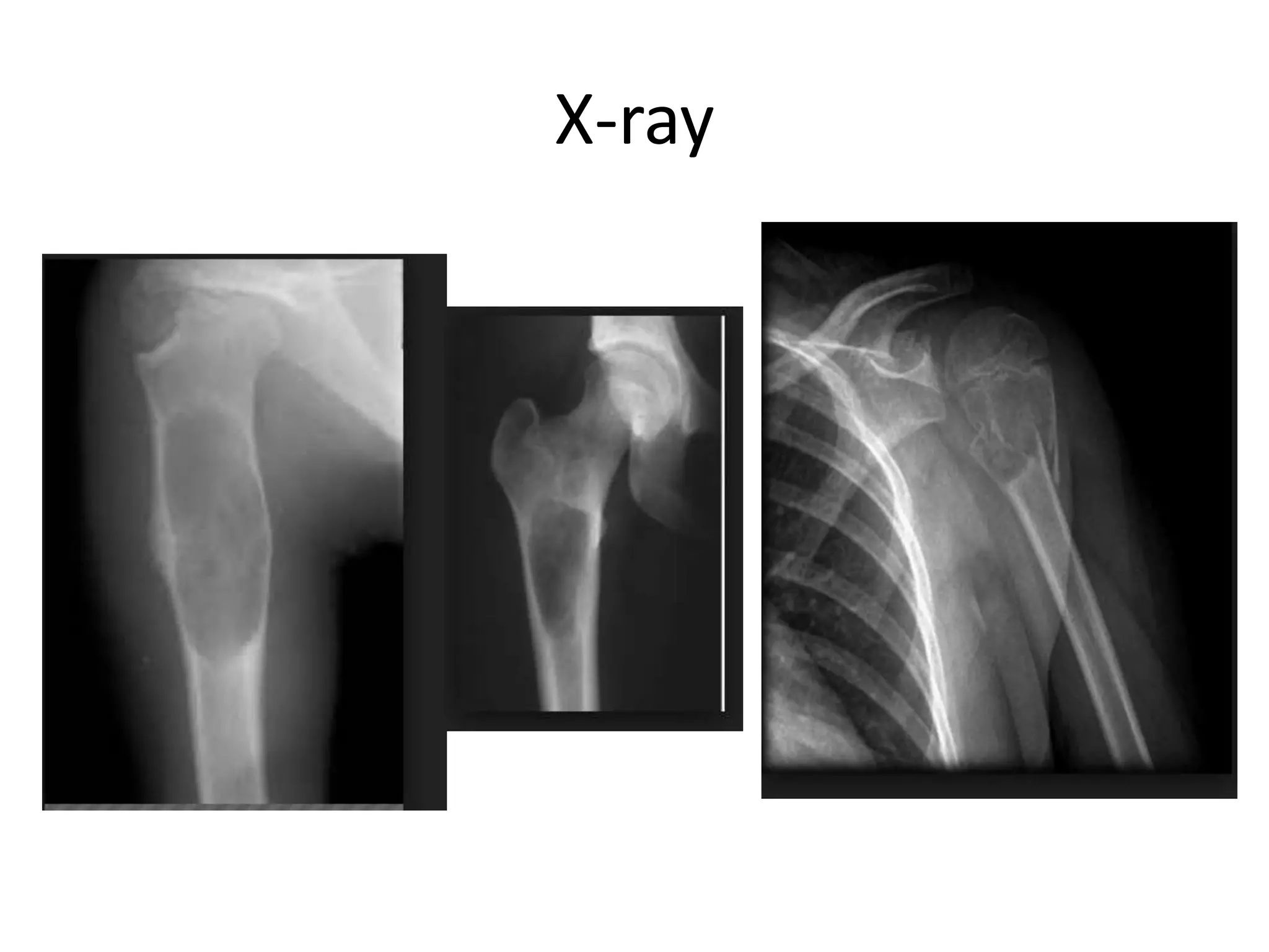 X-ray
 