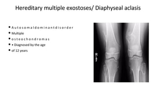 Hereditary multiple exostoses/ Diaphyseal aclasis
• A u t o s o m a l d o m i n a n t d i s o r d e r
• Multiple
• o s t e o c h o n d r o m a s
• • Diagnosed by the age
• of 12 years
 