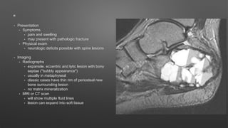 • Presentation
• Symptoms
• pain and swelling
• may present with pathologic fracture
• Physical exam
• neurologic deficits possible with spine lesions
• Imaging
• Radiographs
• expansile, eccentric and lytic lesion with bony
septae ("bubbly appearance")
• usually in metaphyseal
• classic cases have thin rim of periosteal new
bone surrounding lesion
• no matrix mineralization
• MRI or CT scan
• will show multiple fluid lines
• lesion can expand into soft tissue
 