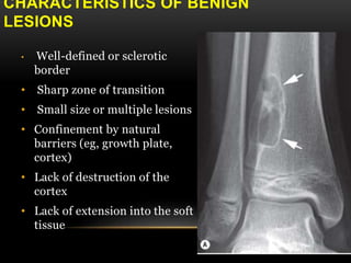 Benign bone tumors an approach | PPTX