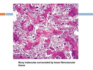 Bony trabeculae surrounded by loose fibrovascular
tissue
 