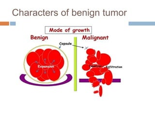 Characters of benign tumor
 