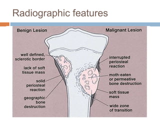 Radiographic features
 