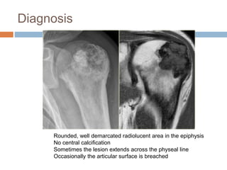 Diagnosis
Rounded, well demarcated radiolucent area in the epiphysis
No central calcification
Sometimes the lesion extends across the physeal line
Occasionally the articular surface is breached
 