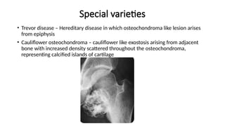 Special varieties
• Trevor disease – Hereditary disease in which osteochondroma like lesion arises
from epiphysis
• Cauliflower osteochondroma – cauliflower like exostosis arising from adjacent
bone with increased density scattered throughout the osteochondroma,
representing calcified islands of cartilage
 