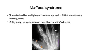 Maffucci syndrome
• Characterised by multiple enchrondromas and soft tissue cavernous
hemangiomas
• Malignancy is more common here than in ollier’s disease
 