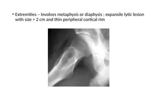 • Extremities – Involves metaphysis or diaphysis ; expansile lytic lesion
with size > 2 cm and thin peripheral cortical rim
 