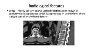 Radiological features
• SPINE – mostly solitary, coarse vertical striations seen known as
corduroy cloth appearance which is appreciated in lateral view: There
is slight overall loss to bone density
 