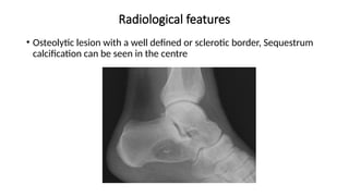 Radiological features
• Osteolytic lesion with a well defined or sclerotic border, Sequestrum
calcification can be seen in the centre
 