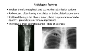 Radiological features
• Involves the diametaphysis and spares the subarticular surface
• Radiolucent, often having a loculated or trabeculated appearance
• Scattered through the fibrous lesion, there is appearance of radio
opacity – ground glass or smoky appearance
• They have a thick sclerotic margin – Rind of sclerosis
 