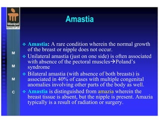 Amastia
Amastia: A rare condition wherein the normal growth
of the breast or nipple does not occur.
Unilateral amastia (just on one side) is often associated
with absence of the pectoral muscles Poland’s
syndrome
Bilateral amastia (with absence of both breasts) is
associated in 40% of cases with multiple congenital
anomalies involving other parts of the body as well.
Amastia is distinguished from amazia wherein the
breast tissue is absent, but the nipple is present. Amazia
typically is a result of radiation or surgery.
 