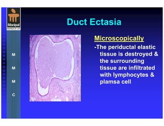 Duct Ectasia
Microscopically
-The periductal elastic
tissue is destroyed &
the surrounding
tissue are infiltrated
with lymphocytes &
plamsa cell
 