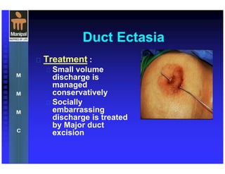Duct Ectasia
 Treatment :
 Small volume
discharge is
managed
conservatively
 Socially
embarrassing
discharge is treated
by Major duct
excision
 