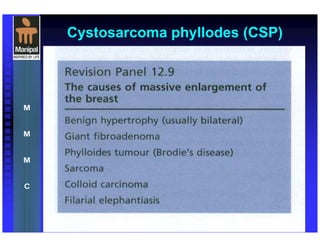 Cystosarcoma phyllodes (CSP)
 