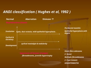 Hughes Classification benign_breast_disease_treatment and management.pptx