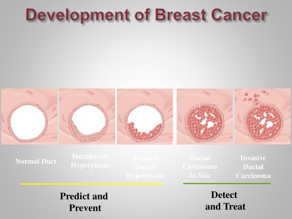 Benign breast disease dr mnr