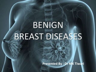 BENIGN
BREAST DISEASES
Presented By : Dr MK Tiwari
 