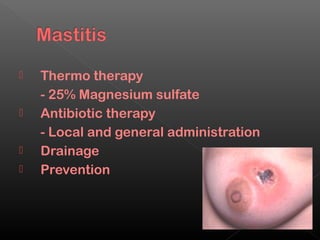    Thermo therapy
    - 25% Magnesium sulfate
   Antibiotic therapy
    - Local and general administration
   Drainage
   Prevention
 